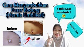 Pusar Bayi Sempat Basah, Berdarah, & Bernanah sampai Muncul Benjolan | Sembuh 100% 