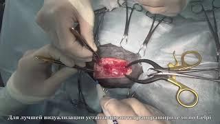 Удаление новообразования щитовидной железы у собаки |  Thyroid tumor removal in a dog