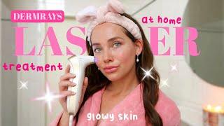 i found the PERFECT at home laser for GLOWY & YOUTHFUL SKIN   DermRays Revive Skincare Laser review