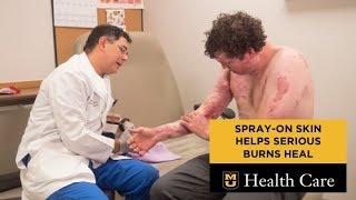 Spray-On Skin Helps Firefighter Heal from Serious Burns (Jeffrey Litt, DO)