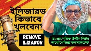 Removal of Ilizarov | ইলিজারভ কিভাবে খুলবেন | Ilizarov | Dr.M.Sharif Uddin Liton