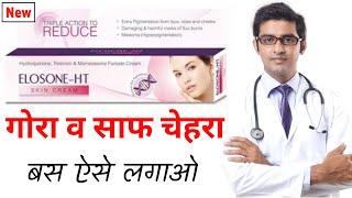 Elosone ht cream uses in hindi 2024 | how to use elosone ht cream in hindi