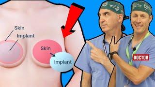 Explant Surgery For Breast Implants - What You Need To Know