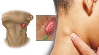 7 Easy Ways To Quickly Unclog Your Lymph Nodes To Reduce Swelling And Flush Out Toxins healthcare️