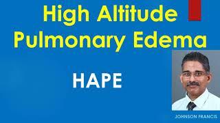 High Altitude Pulmonary Edema