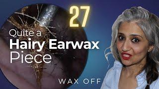 Quite a Hairy Earwax | Wax Off Episode 27