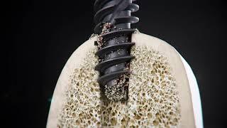 Straumann® BLX Implant System - Full Length Chip Flutes Dynamic Bone Management