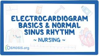 Electrocardiogram (ECG) - Normal sinus rhythm (NSR): Clinical Nursing Care