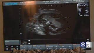 Mobile 4D ultrasound business in Rochester brings elective experience right to your home