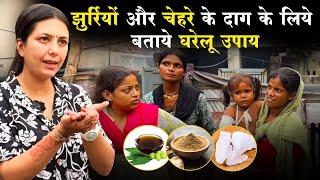 Delhi के Slums में झाइयों और झुर्रियों को ठीक करने के घरेलू उपाय बताये | Upasana Ki Duniya