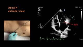 Standard views for a basic echocardiogram