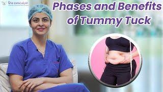 Phases of a Tummy Tuck Procedure | Benefits of Tummy Tuck |️Tummy Tuck Surgery Post Care