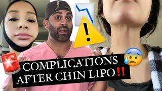 Complications After Chin Lipo *what to look out for*