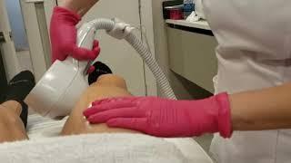 Exilis Skin Tightening at INSIDE BEAUTY  by Dr. Kassir