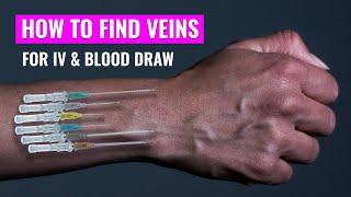 How to find a vein | Nursing phlebotomy | Vein Finder | Finding vein for IV | Christina NP |