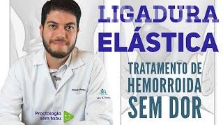 Ligadura elástica de hemorroida, você conhece esse tratamento? Tratamento para hemorroida interna