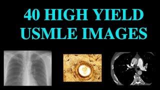 40 High Yield Images for USMLE (CT, XRay, Histology)