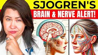 Sjogren's Can Affect Your Brain and Nerves