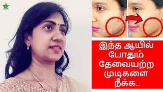 Remove unwanted hair permanently at home in Tamil | Tamil face care video | asha lenin video