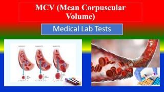 MCV (Mean Corpuscular Volume) - Medical  Lab Tests -What is ? ,Uses ,Need ,Preparation , Results