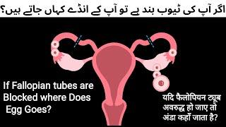 Pregnancy & Blocked fallopian tube | Egg Kaha Jaye ga agr tubes band ha Tu? Reason for blocked tubes