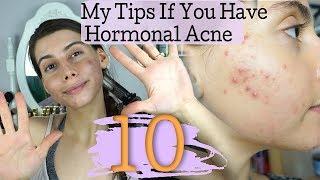 MY TOP 10 TIPS FOR REVERSING HORMONAL ACNE || What I did wrong, what I can do better!