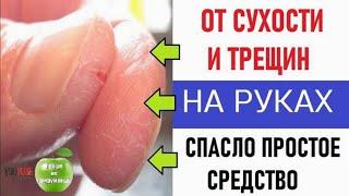 От сухости и трещин на руках. Обветрил руки - помогло. Личный опыт.