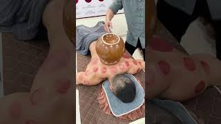 You should not inhale when opening a cupping cups #asmr #cuppingtherapy #youtubeshorts #relax #china