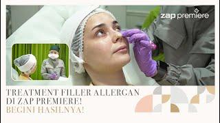 Coba Treatment Filler Pertama Kali! Rasanya Ternyata...