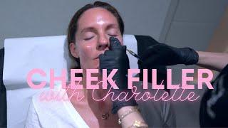 Dr Nina Cheek Filler | Dr. Nina Bal | London UK