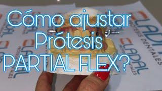 Cómo ajustar prótesis flexibles Partial Flex?