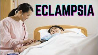 Eclampsia (updated 2023) - CRASH! Medical Review Series