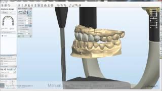 Dental System™ 2010 - Dynamic Virtual Articulation