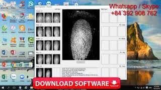 Dmit software | Instructions for using the trial version Dmit software | Dmit software price