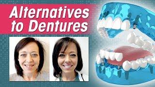 Alternative to Dentures: Comparing Dentures, Overdentures, All-on-4 and 3 on 6™