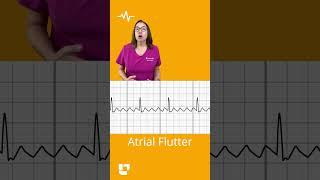 Difference between atrial fibrillation and atrial flutter F