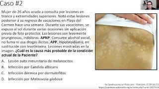 Casos clínicos - Dermatología septiembre parte 1 de 3