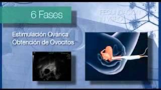 IVI - Fecundación in vitro (FIV) paso a paso y transferencia de embriones (UE, 2014)