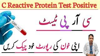 C Reactive Protein Blood Test Urdu Hindi | CRP Blood Test | CRP Test Normal Levels | Irfan Azeem |