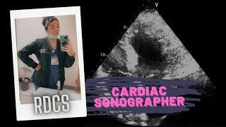 Life of a Registered Diagnostic Cardiac Sonographer | Echocardiography
