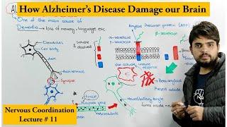 Alzheimer's Disease