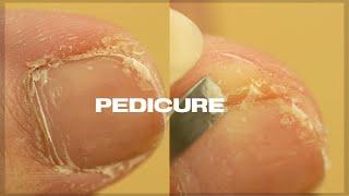 Satisfying PEDICURE TRANSFORMATION at home | Cuticle & Callus Removal