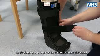 Splints: Static walking boot