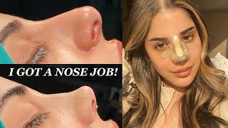 I GOT A NOSE JOB IN TURKEY WITH THE BEST SURGEON! - PART 1 | CLINICHUB