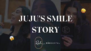 Ju-Ju Sheikh's Composite Bonding Smile Transformation With Ruh Dental