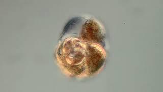 Foraminifera