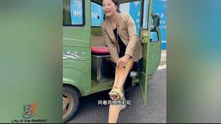 The beautiful woman has very short legs. She uses a prosthetic leg as if it were an amputee # ampute