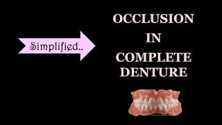 OCLUSION IN COMPLETE DENTURE / BALANCED OCCLUSION