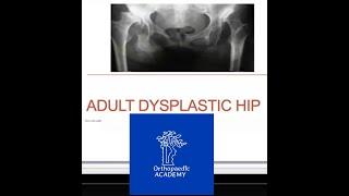 Adult Hip Dysplasia | Acetabular Protrusio - The FRCS Questions