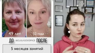 Как убрать десневую улыбку